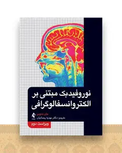نوروفیدبک مبتنی بر الکتروانسفالوگرافی